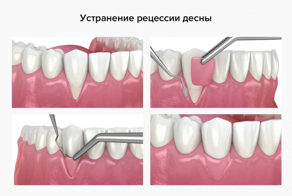 4749_plastikazub-1024x687